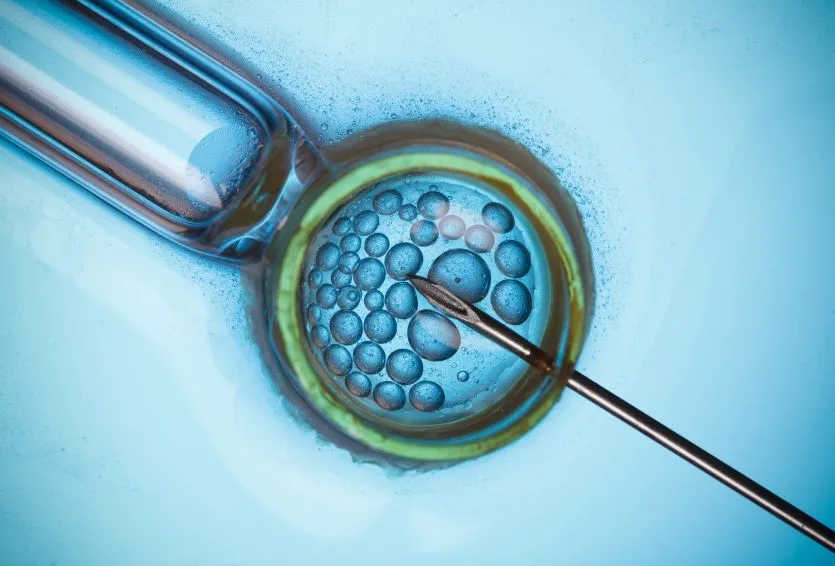 Mini IVF vs. Conventional IVF: Which Is Better for Poor Responders?